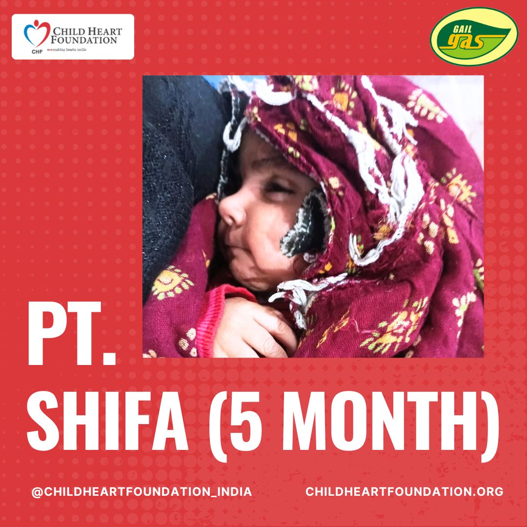 Shifa (five months old ), a little braveheart girl